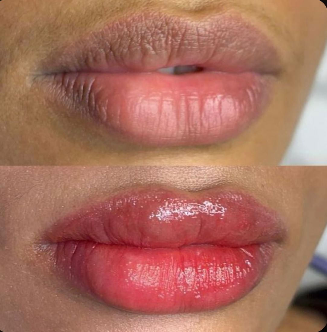 CURSO DE MICROPIGMENTACIÓN DE LABIOS — foto 2