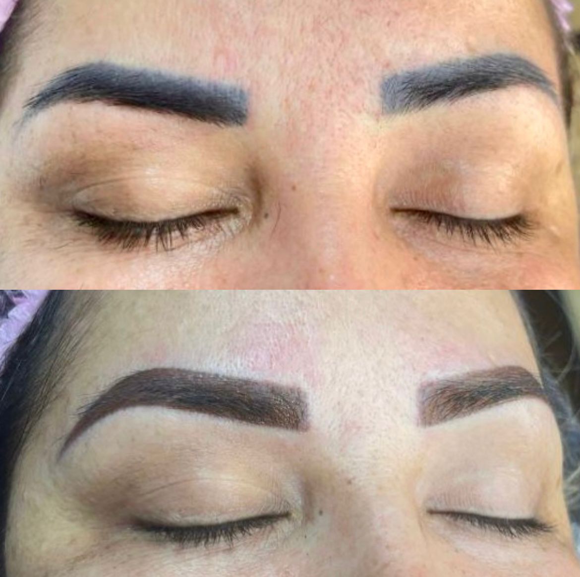 NEUTRALIZACIÓN DE CEJAS